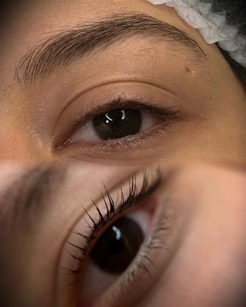 Antes e depois — Volume Fox Eyes